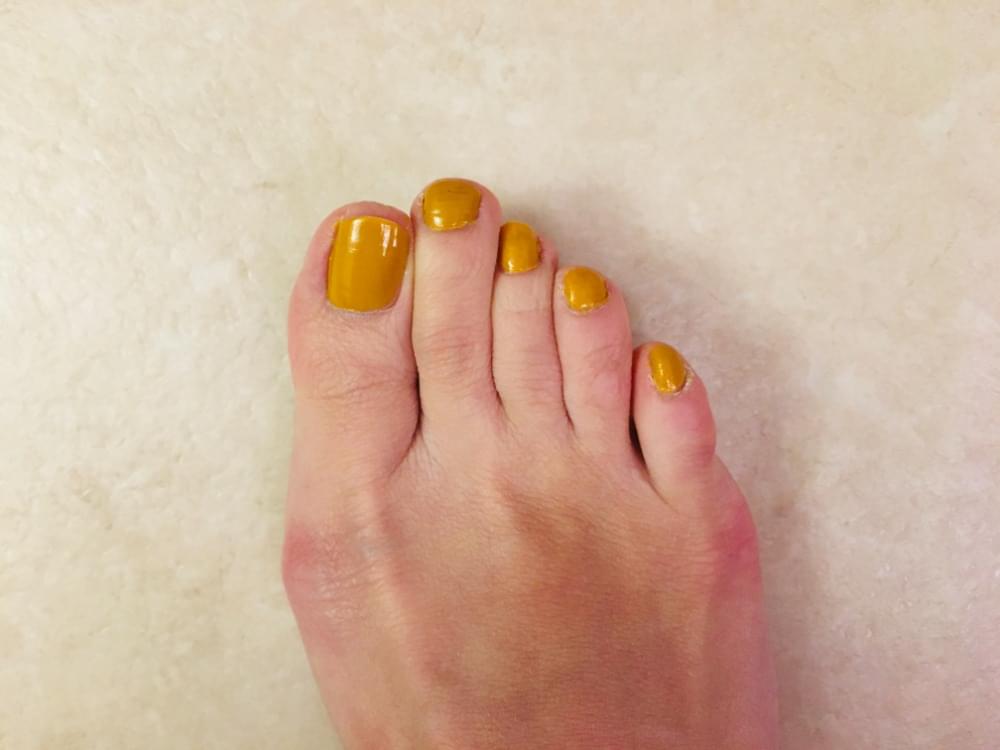 外反母趾でこんな症状に悩んでいませんか？